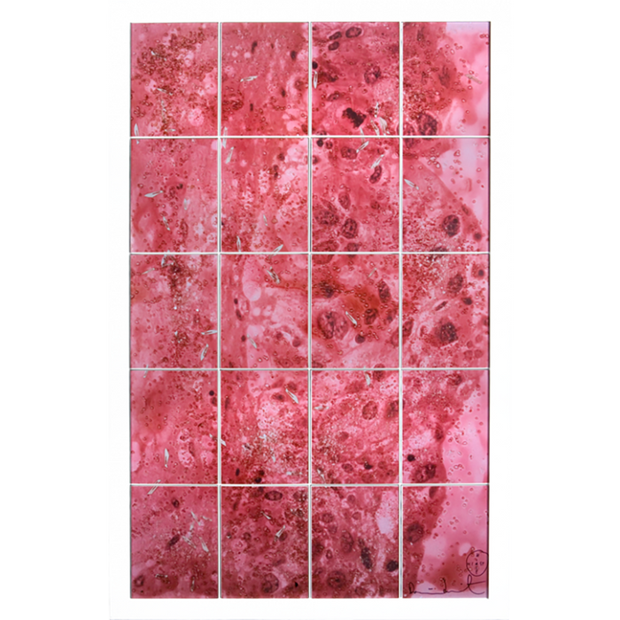 Damien Hirst – a complete ‘Biopsy Painting’ reproduction